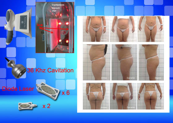 Cryo che congela il peso dell'attrezzatura del laser Lipo perde la macchina domestica di bellezza