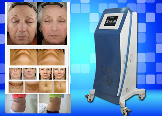 Cryo che congela il peso dell'attrezzatura del laser Lipo perde la macchina domestica di bellezza